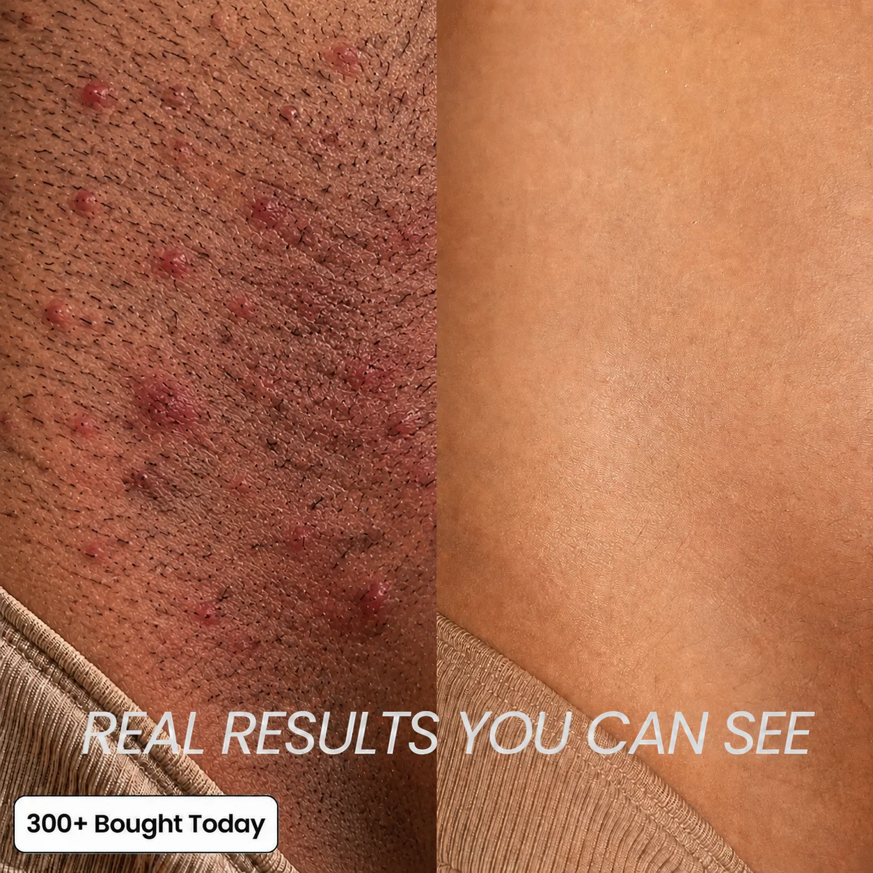 Anti-Hair Growth Oil - Image 7