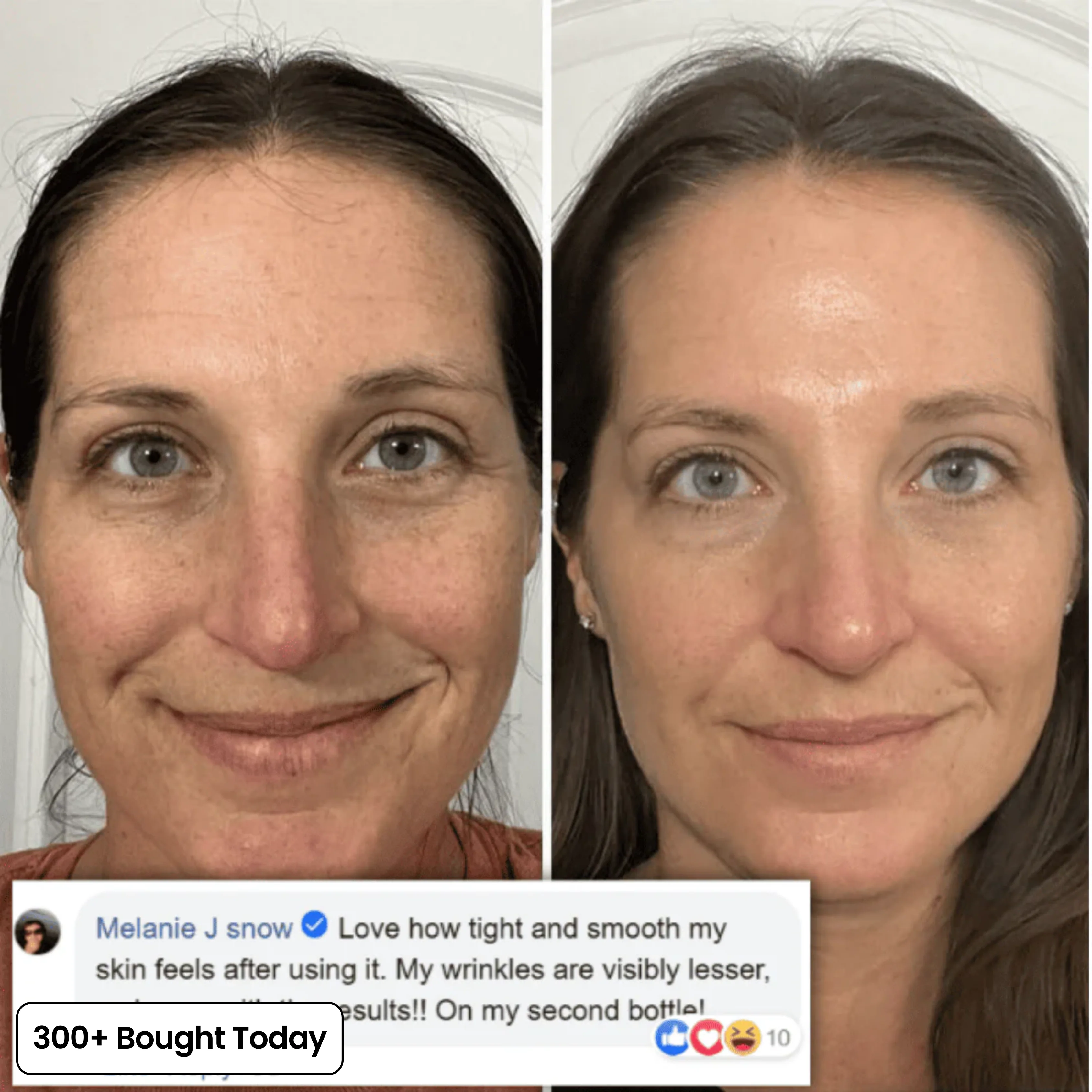 Transform Wrinkles, Fine Lines, And Tired Creases, Naturally! - Image 8