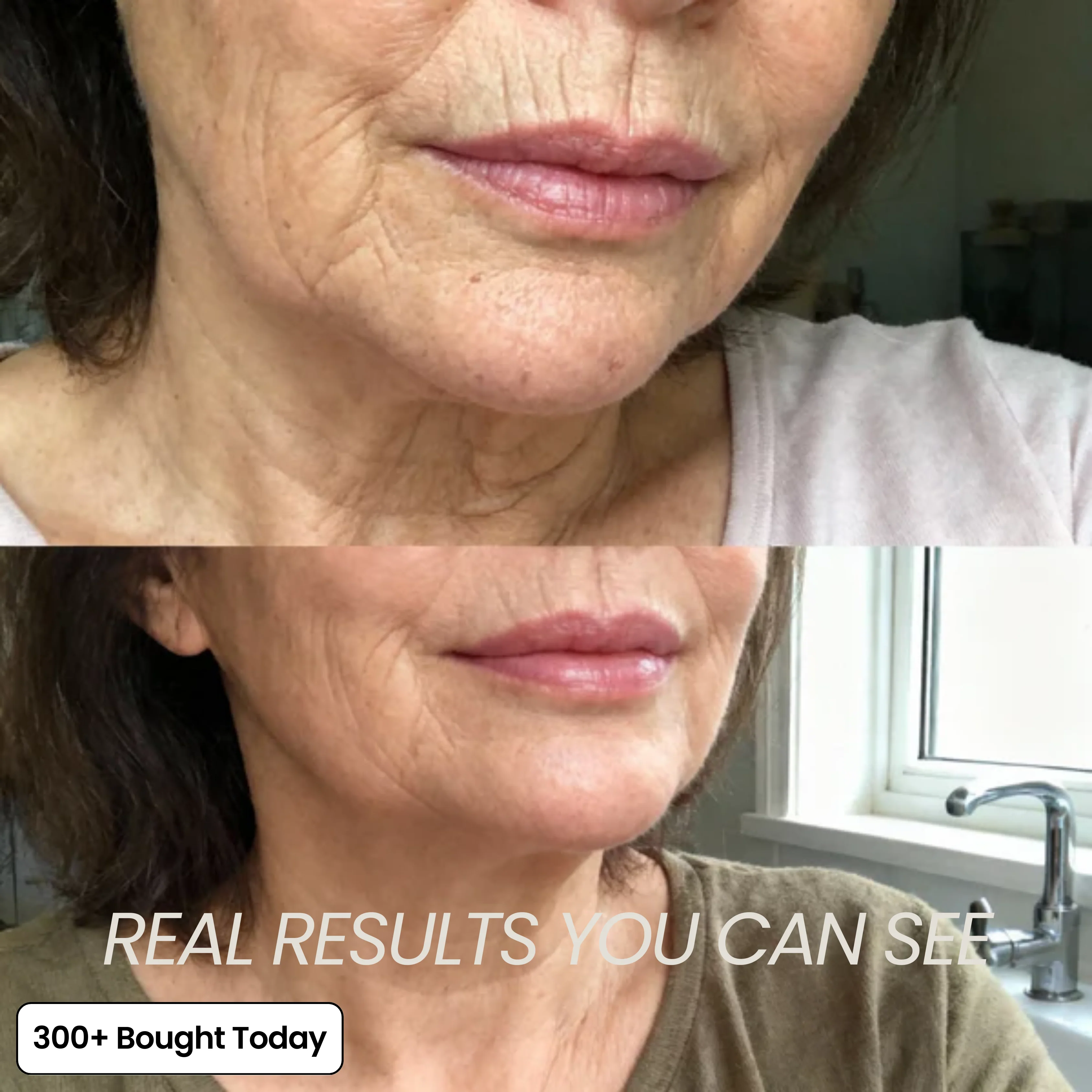 Transform Wrinkles, Fine Lines, And Tired Creases, Naturally! - Image 4