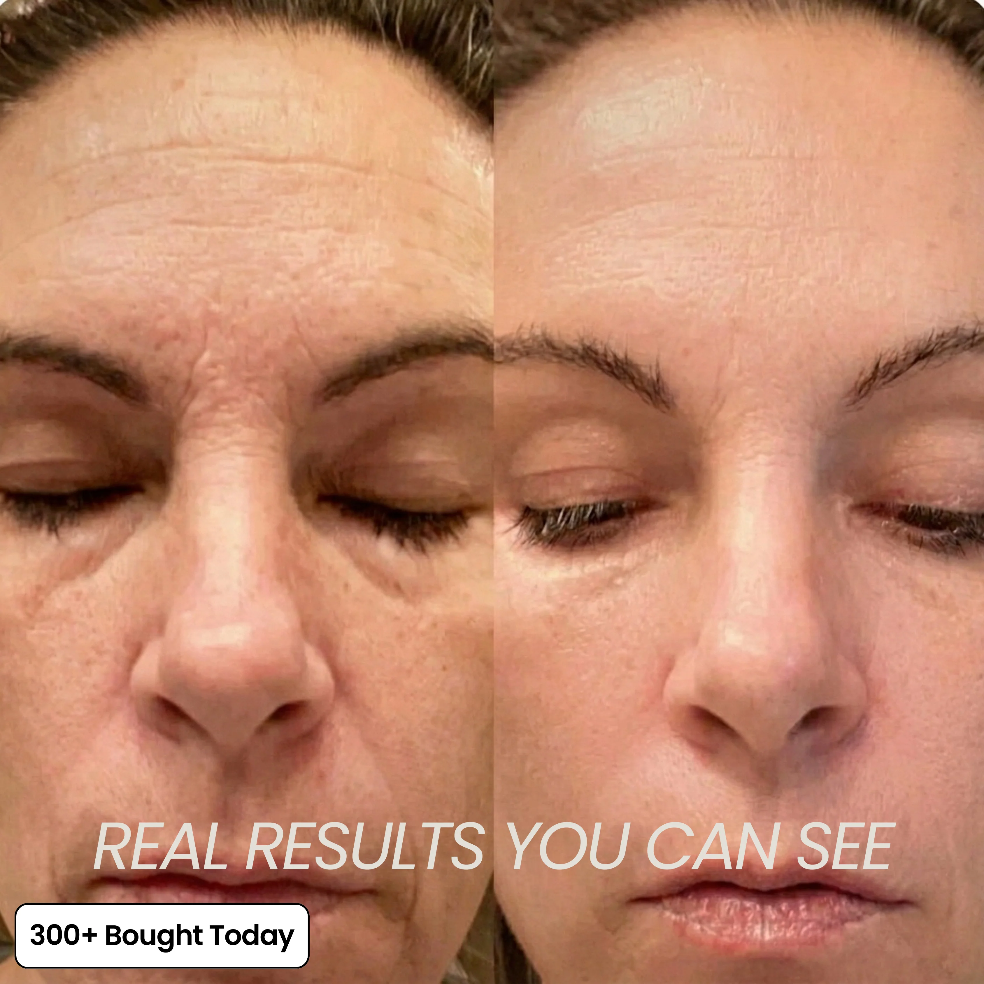 Transform Wrinkles, Fine Lines, And Tired Creases, Naturally! - Image 5