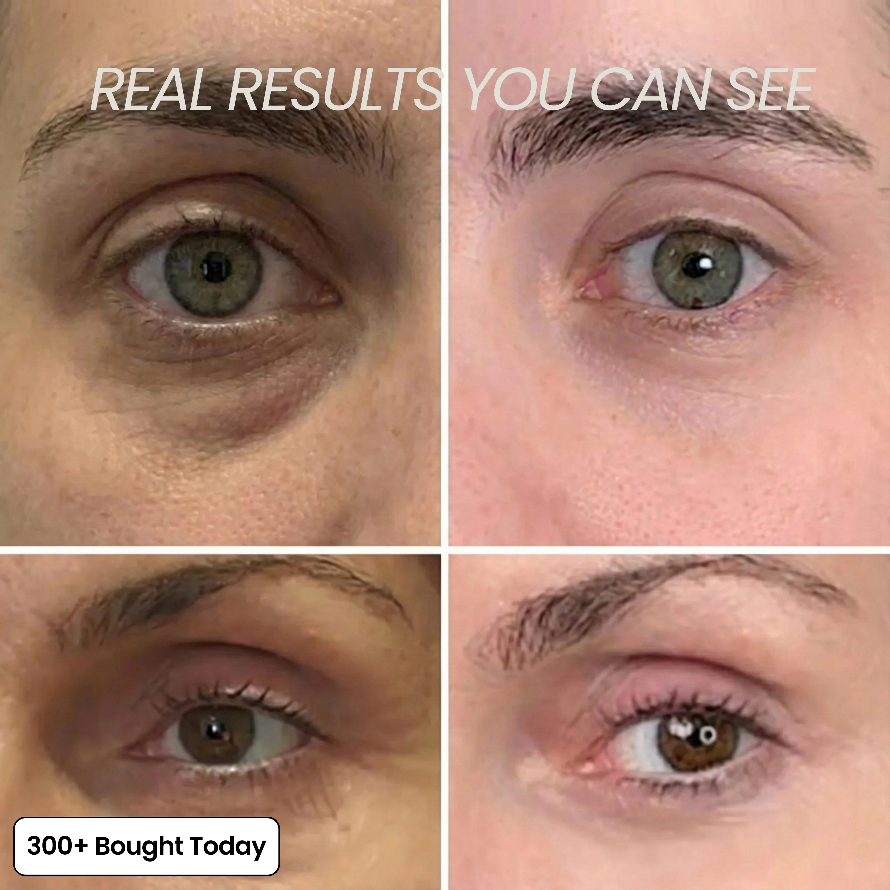 Transform Wrinkles, Fine Lines, And Tired Creases, Naturally! - Image 6