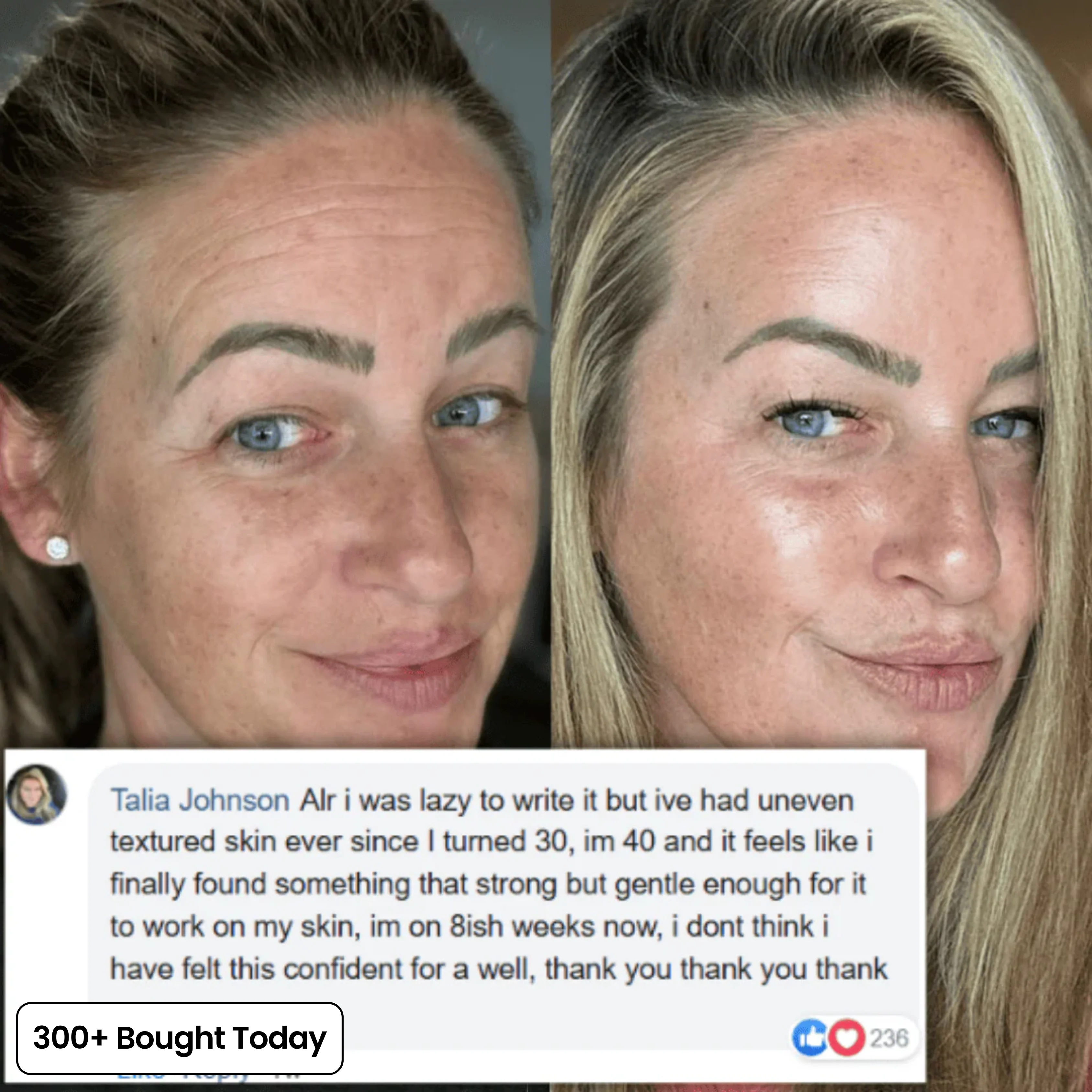 Transform Wrinkles, Fine Lines, And Tired Creases, Naturally! - Image 7